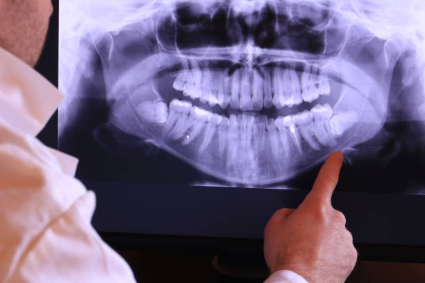 Best Weekend Emergency Dentist in Fort Lewis, WA