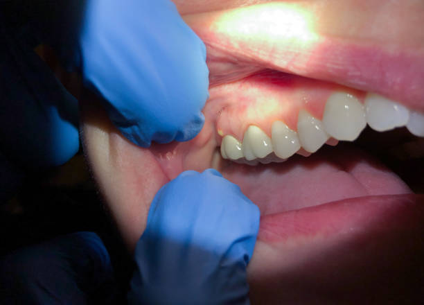 Best Mobile Emergency Dentist in Fort Lewis, WA