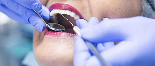 Best Emergency Dentist for Knocked-Out Tooth in Fort Lewis, WA